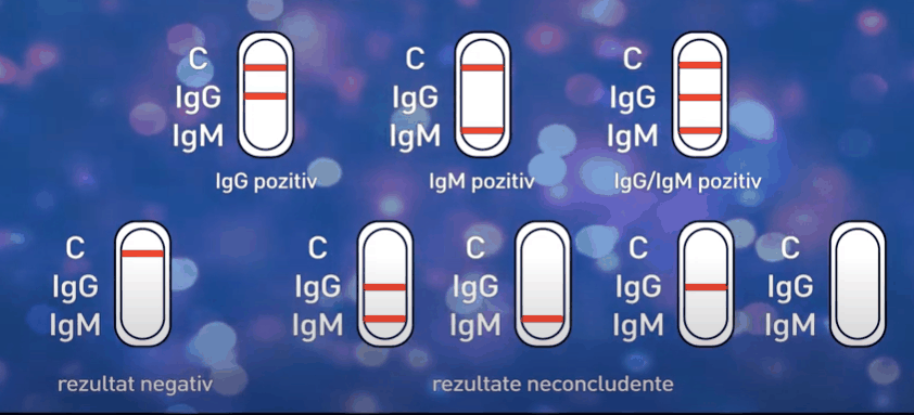 rezultat test rapid IGGIGM